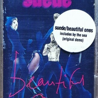 Beautiful Ones by Suede
